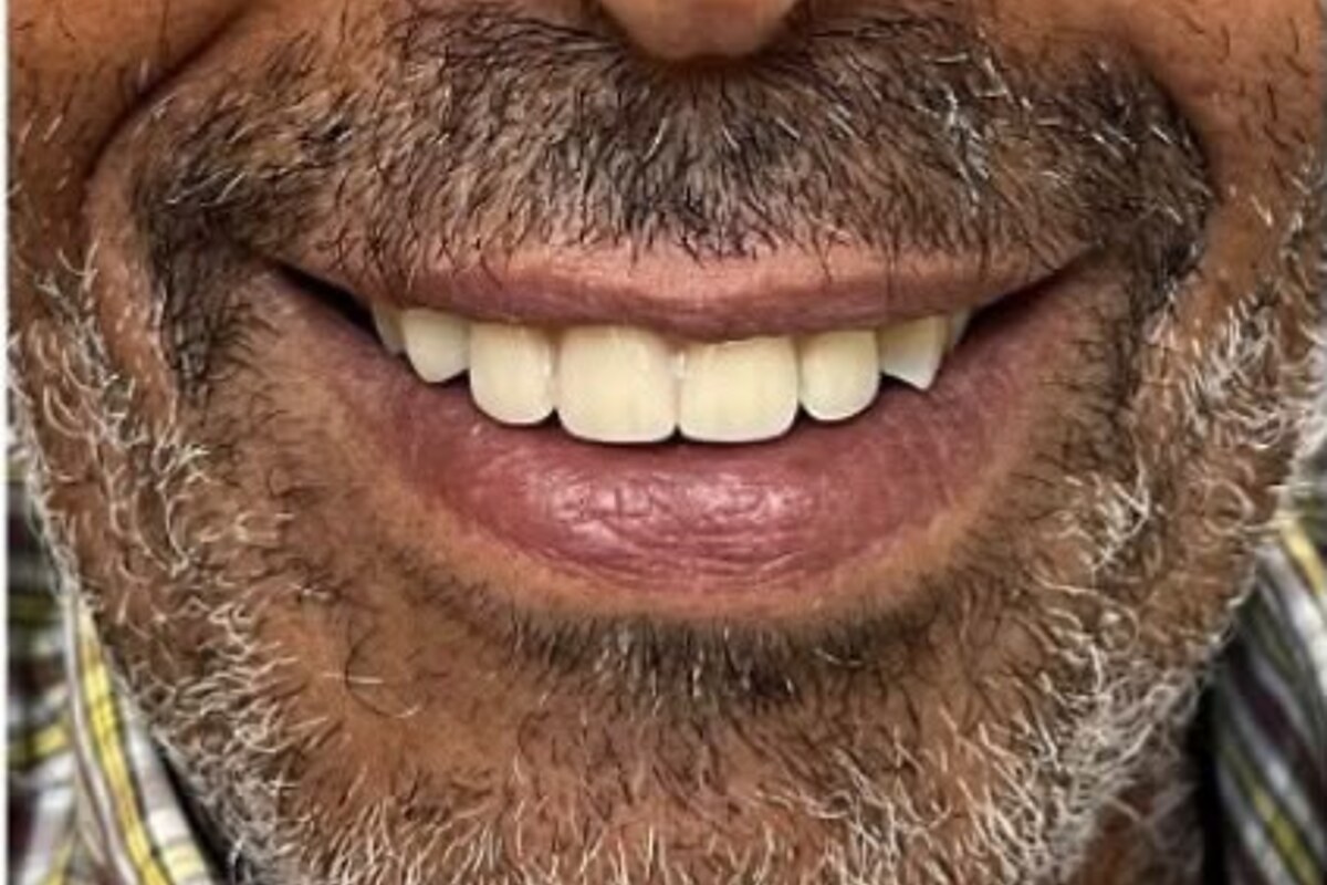 Depois do caso de Implantodontia